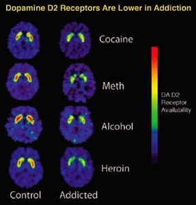 Science of Addiction