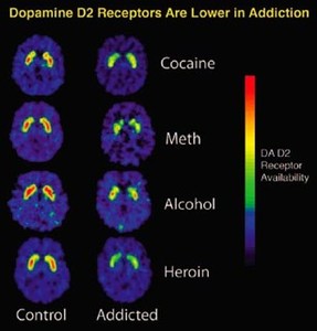 Science of Addiction