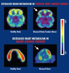 Science of Addiction